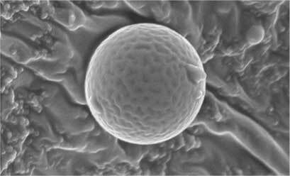 エンキャプレーションの拡大断面図
